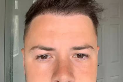 En marzo de este año, Horsfield se hizo un nuevo trasplante en Inglaterra, y esta vez le quedó al pelo, literalmente