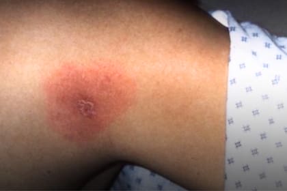 En mayo de 2025, las visitas a emergencias por estas afecciones crecieron un 30%