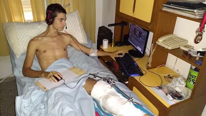 En plena recuperación tras la amputación de una de sus piernas