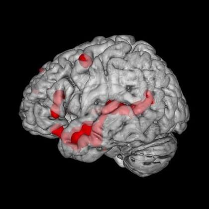 En rojo, las regiones del cerebro que se activan durante la lectura de historias de ficción