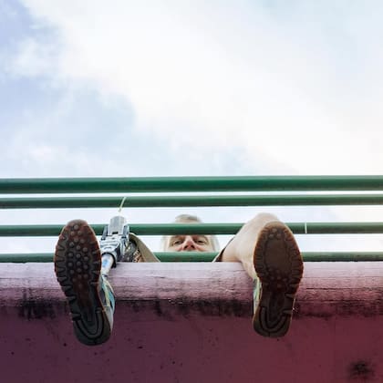 En San Francisco también le tomaron el molde para hacerle una pierna ortopédica