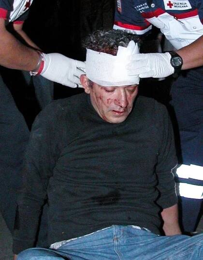 En su intento de huir de la Policía antes de que llegaran al departamento 17 en Mosqueta 198, Calva se accidentó y tuvo que ser atendido por paramédicos