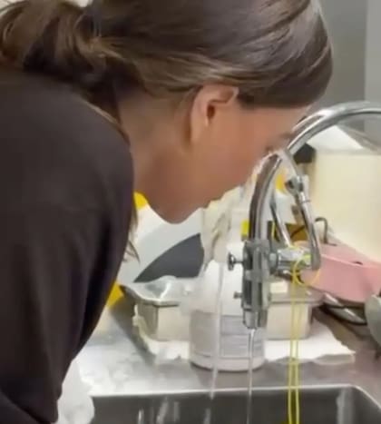 En sus historias, la estrella colombiana mostró cómo buscaba aliviar la reacción alérgica en su ojo