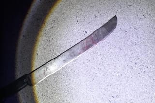 Discutió con un vecino por un auto estacionado frente a su casa y le cortó la oreja con un machete