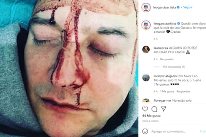 Ensangrentado y con dificultad para hablar, Leo García denunció que fue brutalmente golpeado por homofobia
