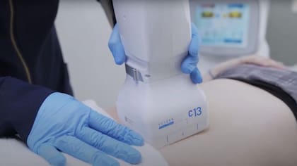 Entre las tecnologías más populares de Classys se destacan sistemas de lifting no invasivo y equipos para estimular la producción de colágeno