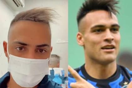 Entre memes y videos, Grego contó por qué decidió hacerse la cirugía