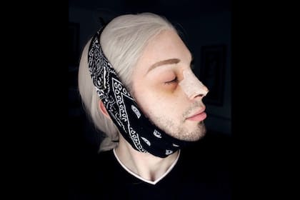 Entre sus operaciones se encuentran: la forma de los ojos, el color, la nariz "de duende" y los labios