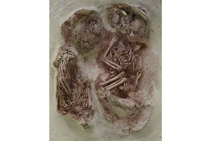 Eran dos gemelos varones monocigotos (idénticos)