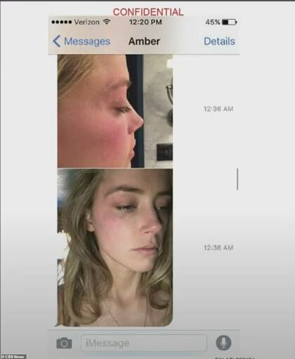 Erin Falati compartió en el tribunal fotografías que Amber Heard le envió y refirió que la actriz manifestó que tenía "tendencias suicidas" (Crédito: Daily Mail)