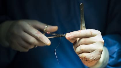 Es biodegradable y biocompatible, lo que la hace ideal para suturas quirrgicas.