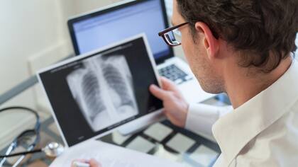 ¿Es conveniente vacunarse contra la neumonía?