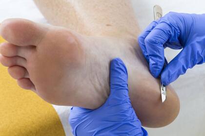 Es importante dedicarle un cuidado especial a los pies