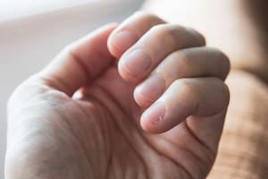 Cómo tus uñas te ayudan a detectar enfermedades