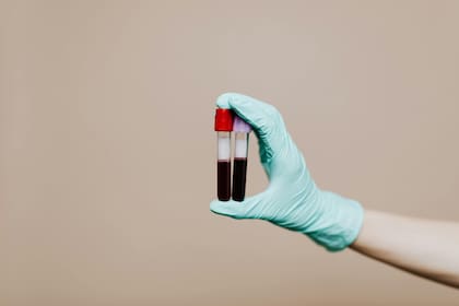 Es imposible predecir cuánta placa de colesterol se ha acumulado revistiendo la pared de las arterias con análisis clínicos de laboratorio