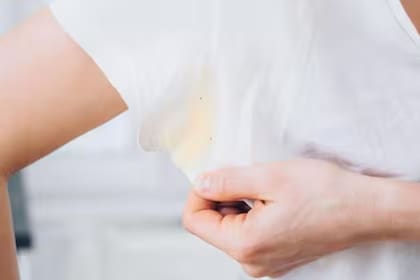 Es posible eliminar las manchas amarillas de la ropa blanca