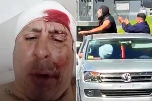 Escalada de violencia entre barrabravas de La Plata: uno de los heridos se filmó internado y prometió venganza