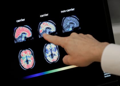 Escaneo del cerebro que permite observar redes neuronales vinculadas al desarrollo y al envejecimiento
