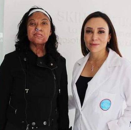 Esmeralda Millán con Isela Mendez, la cirujana que la ayudó con sus operaciones