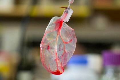 Espinaca tratada para su potencial uso como plasma para reparar las paredes del corazón