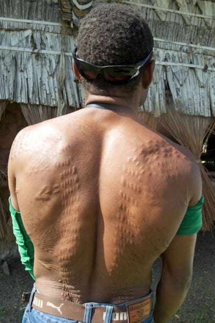 En Papua Nueva Guinea, los niños participan en las ceremonias en honor del Espíritu del Cocodrilo del río Sepik,donde se les cortan la espalda y les quedan cicatrices similares a la piel de un cocodrilo