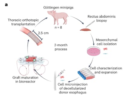 Esquema de la preparación del injerto de esófago creado íntegramente en un laboratorio