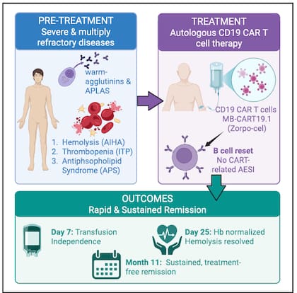 Esquema del tratamiento y la evolución clínica de la paciente: antes de la terapia celular presentaba tres enfermedades autoinmunes graves; tras una única infusión de células CAR‑T, logró una remisión rápida y sostenida