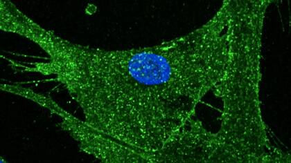 Esta célula magnificada es de una mujer de 52 años. Sin embargo, se comporta como la célula de una mujer de 23