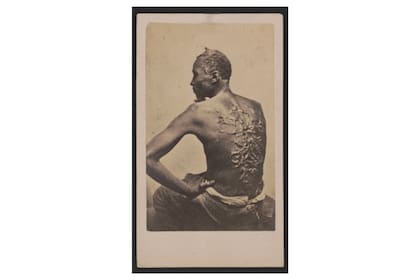 Esta fue la imagen que impactó a miles de personas durante la Guerra Civil en Estados Unidos en 1863, la espalda de "Peter azotado", un esclavo que escapó de sus opresores
