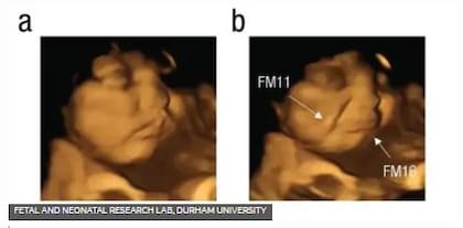 Esta imagen del estudio FETAP (Preferencias de sabor fetal) muestra un feto haciendo muecas a la derecha, como reacción al sabor de la col rizada