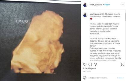 Estefanía Pasquini compartió una foto de la última ecografía de Emilio, el bebé que espera con Alberto Cormillot, que nacerá el 21 de septiembre