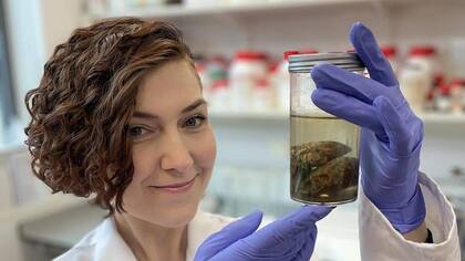 "Estudiar cerebros antiguos podría ayudarnos a comprender el desarrollo y la naturaleza progresiva de la demencia".