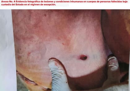 Evidencia fotográfica de lesiones y condiciones inhumanas en cuerpos de personas fallecidas bajo el régimen de excepción en El Salvador