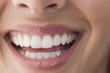 Existen diversos factores que cambian el color de los dientes