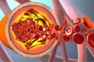 Claves para entender cuándo es peligroso o riesgoso para tu salud