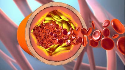 Existen tres fracciones conocidas de colesterol: el bueno, el malo y el feo