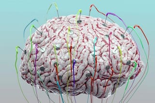 ¿Puede la estimulación tecnológica mejorar el funcionamiento de nuestro cerebro?