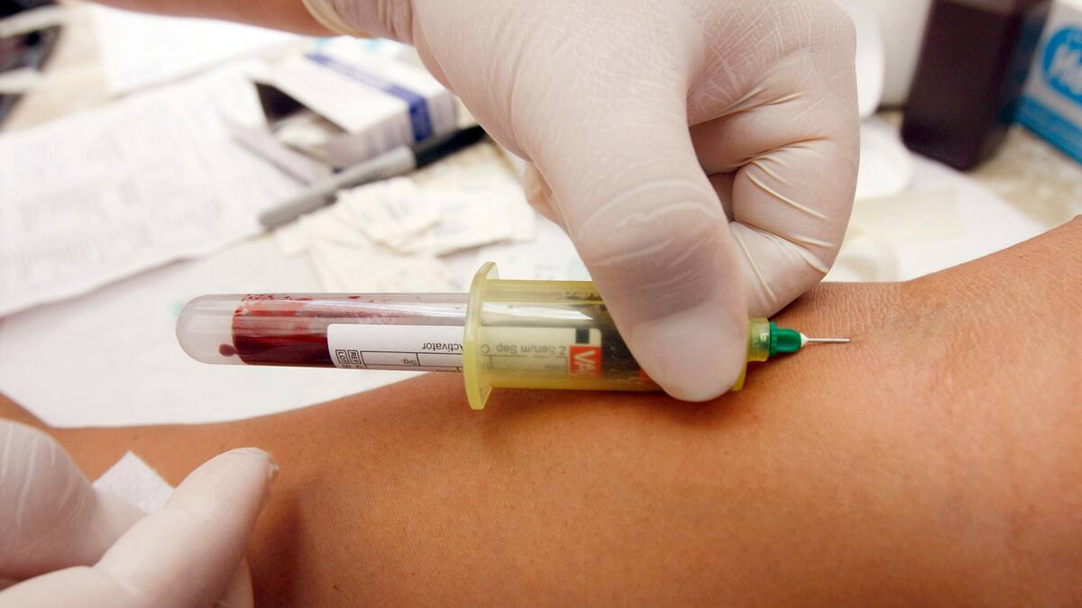 Ocorre uma perigosa doença sexualmente transmissível Ocorre uma perigosa doença sexualmente transmissível