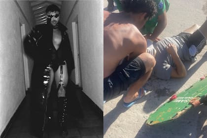 Facundo Mazzei mostró cómo quedó tras su accidente