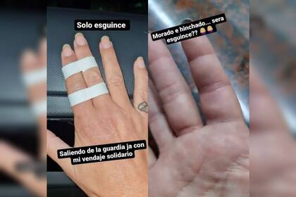Farro se lesionó los dedos (Foto Instagram @moni.farro)