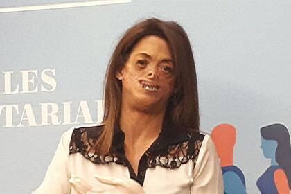 Fide no tiene tiempo para los que se han quedado en la superficie y no han conocido a la mujer en la que se ha convertido ahora