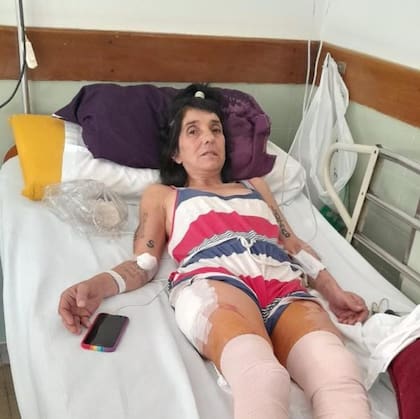 Finalmente, tras 35 días de espera, la paciente fue operada el jueves pasado