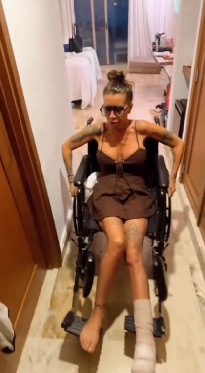 Florencia Peña contó cómo fue el accidente que tuvo tras llegar a República Dominicana