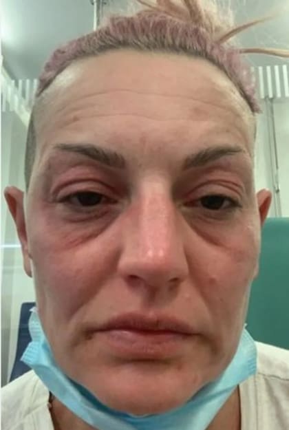 Flower piensa que su médico de cabecera la diagnosticó de manera incorrecta y eso le dañó su salud