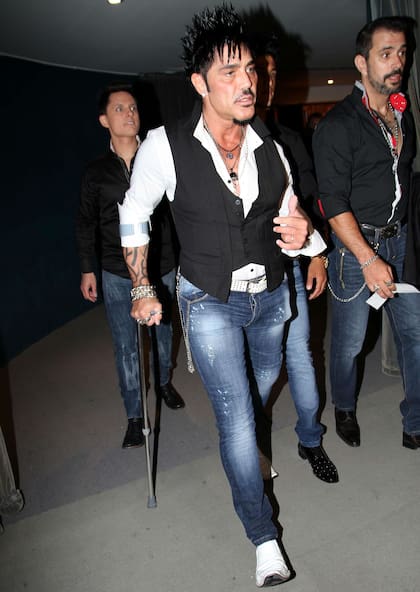 Fort tiene la rodilla destrozada