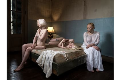 Foto de la serie "Piel de luna", que derivó de un proyecto anterior: "Albinos"