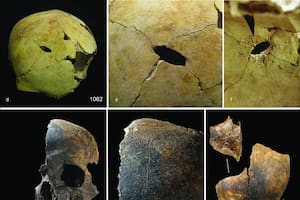 Fragmentos de cráneo, con indicios de traumatismo por objeto contundente y cortes, hallados en la fosa común de Charterhouse Warren, en el suroeste de Inglaterra