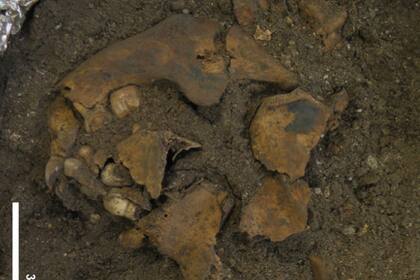 Fragmentos de la mandíbula y la bóveda craneal