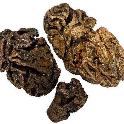 Fragmentos del cerebro de un individuo que fue enterrado en Reino Unido hace cerca de 200 años. No se halló en el esqueleto ningún otro tejido blando.