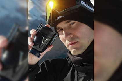 Fran Tinelli habló de la operación a la que se sometió (Foto Instagram @frantinelli1)